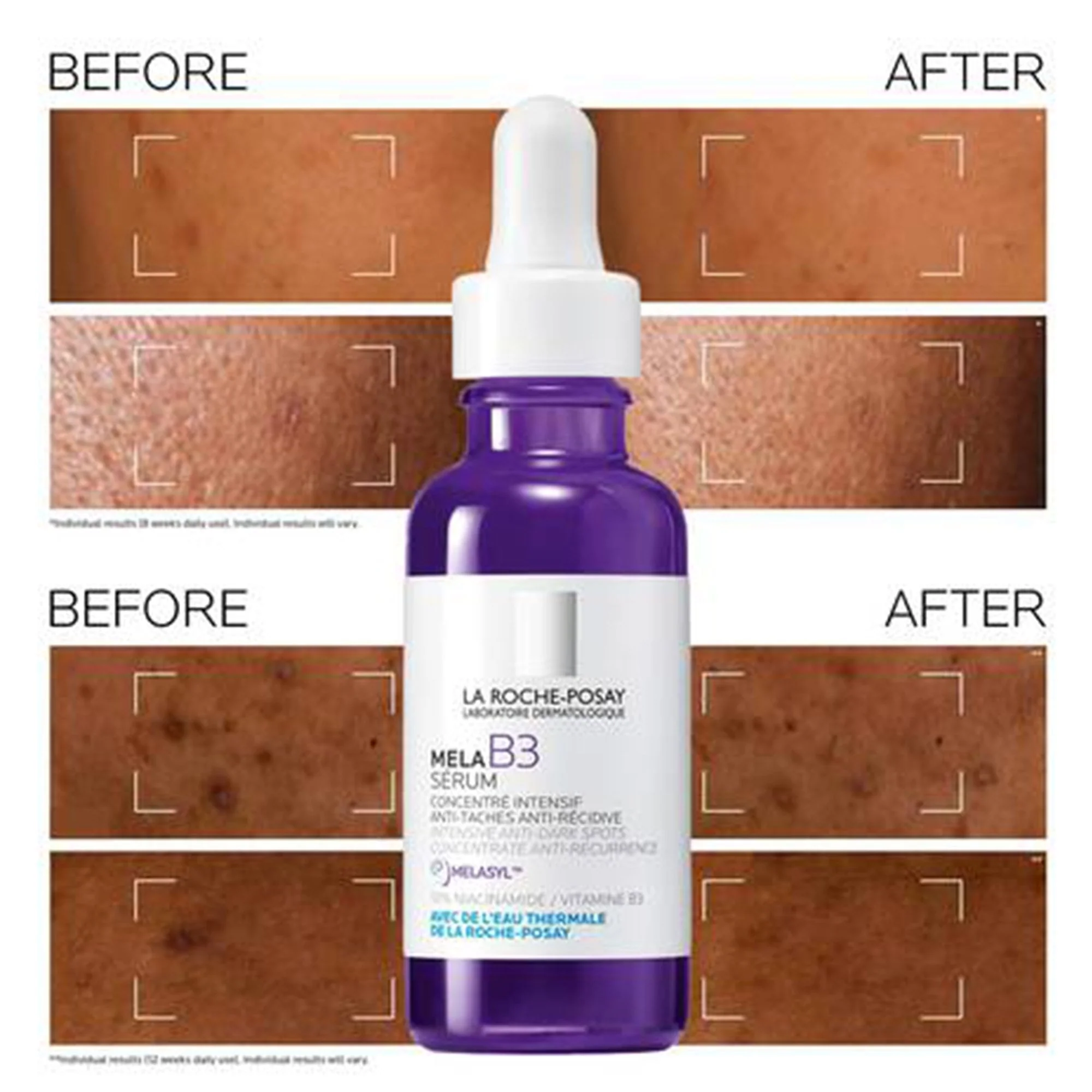 La Roche-Posay Mela B3 Serum 30ml Bottle - Image 3