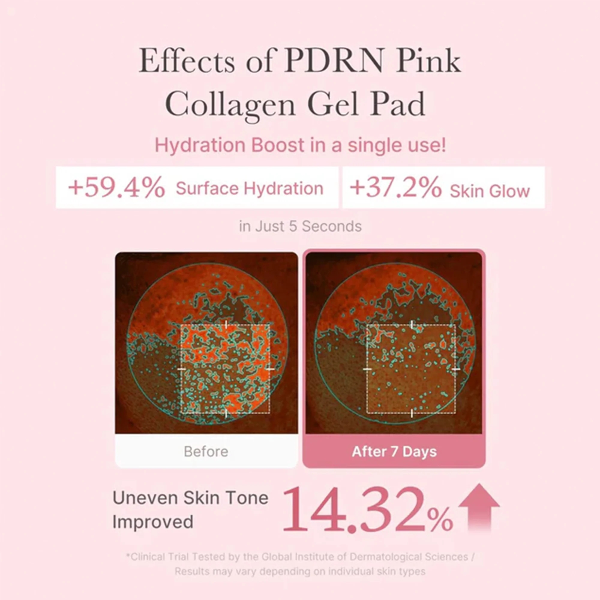 Medicube PDRN Pink Collagen Gel Toner Pad 70pcs Tub - Image 6