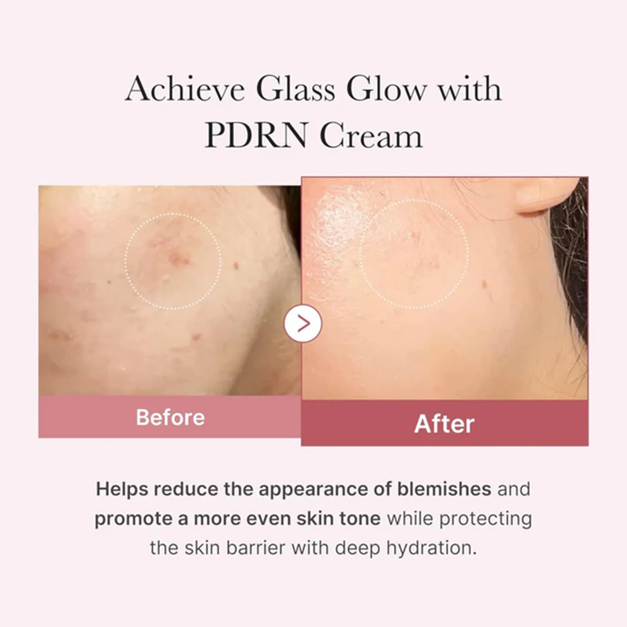Medicube PDRN Pink Collagen Moisturising Cream 50ml Tube - Image 4