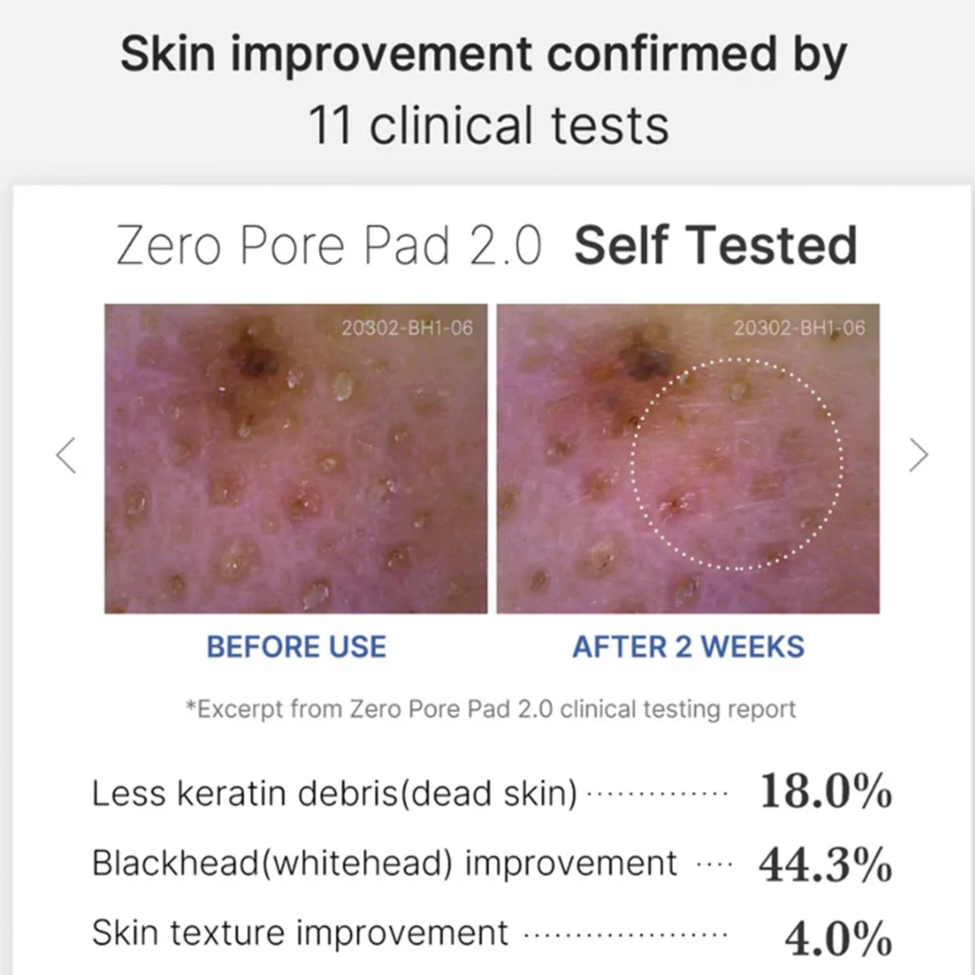 Medicube Zero Pore 2.0 Toner Pad 70pc Tub - Image 5