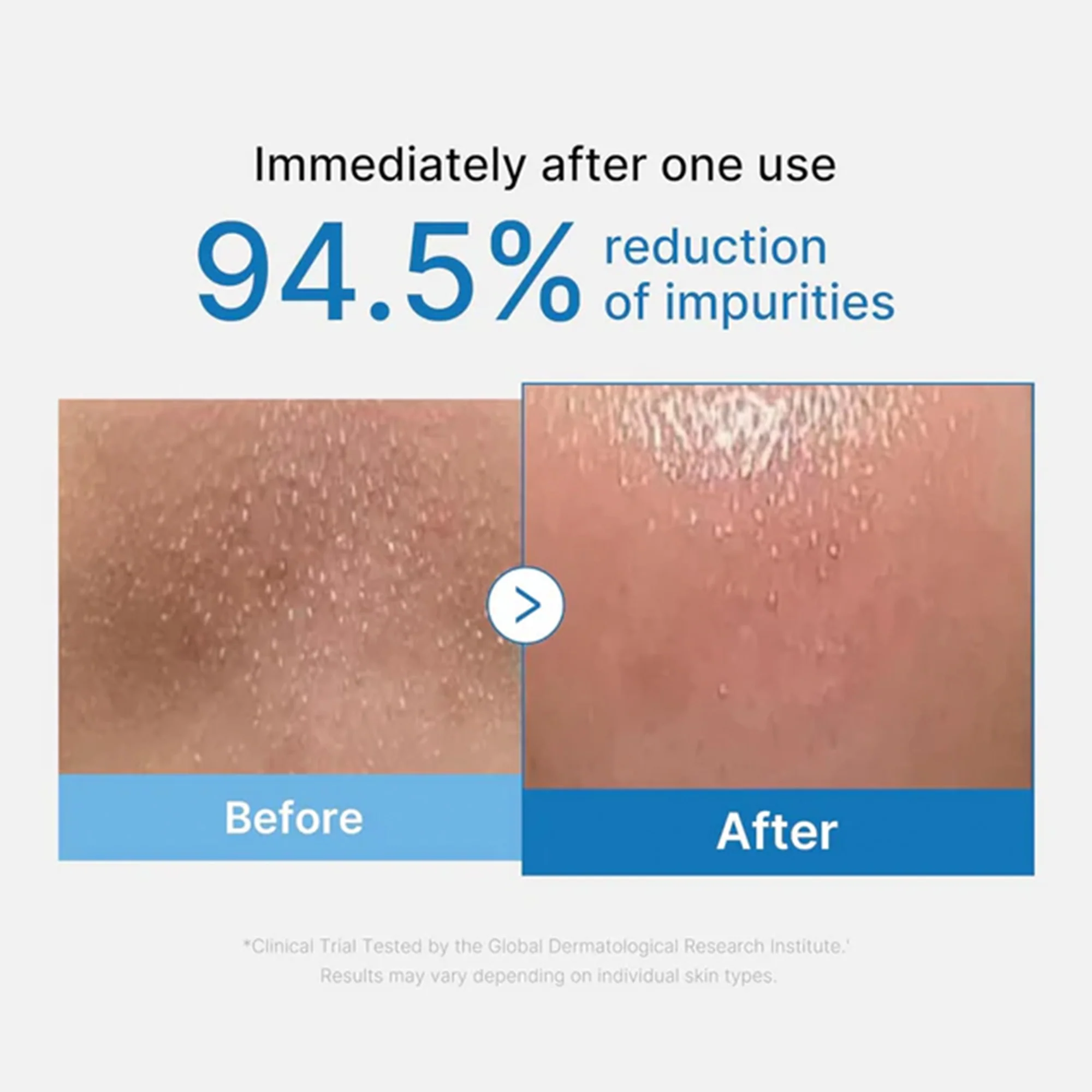 Medicube Zero Pore Blackhead Cleansing Oil 205ml Tube - Image 3